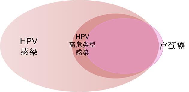 HPV和宫颈癌有什么关系？HPV疫苗咋打？干货在这