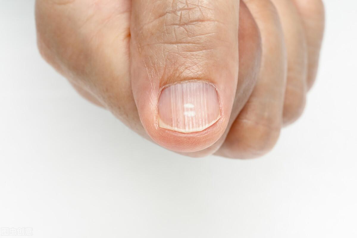 指甲上的“竖纹”，绝不是自然衰老，而是身体发出的“求救信号”